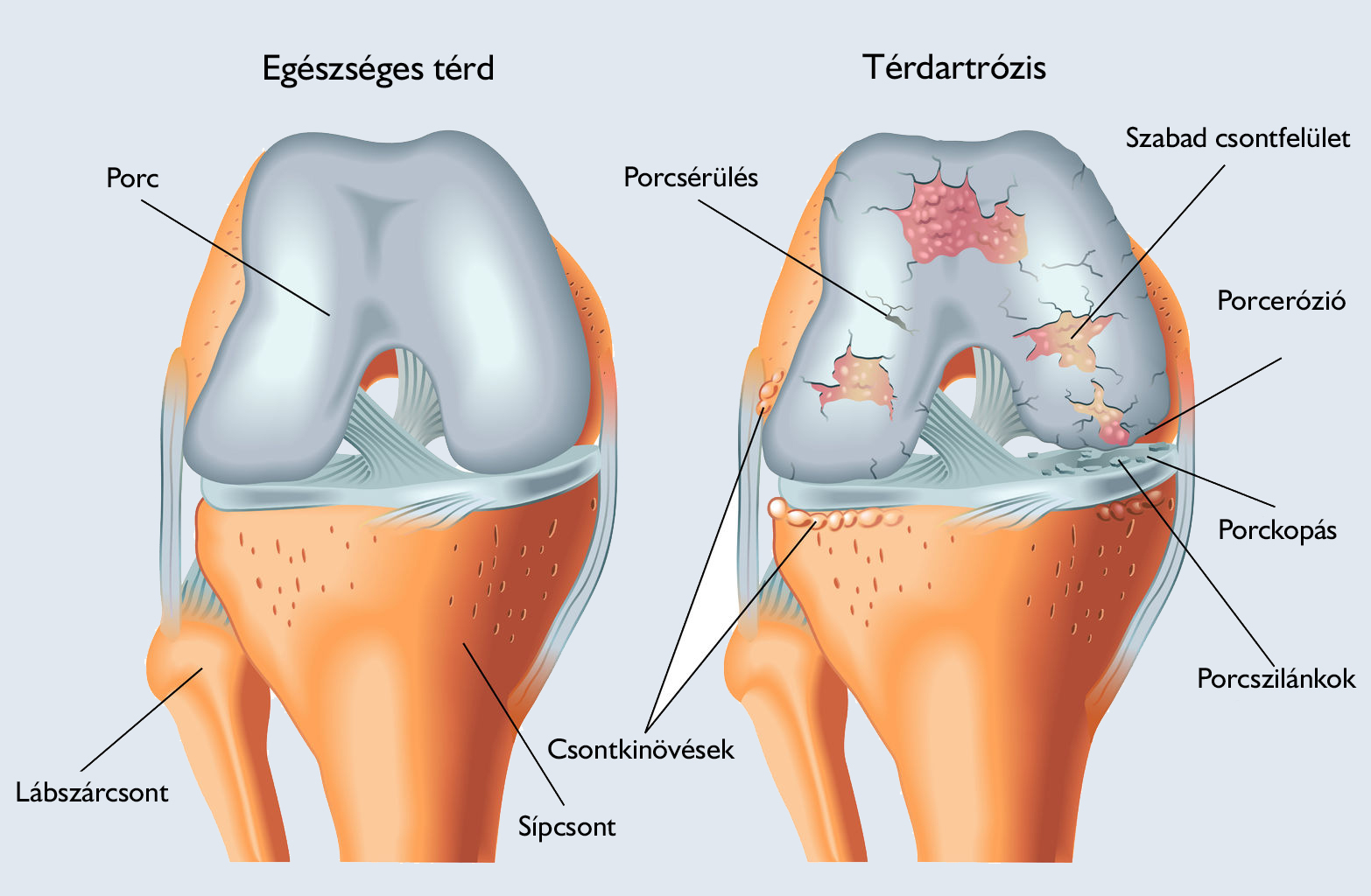a jobb térdízület ízületeinek sérülése fájdalom a lábak ízületeiben és duzzanat