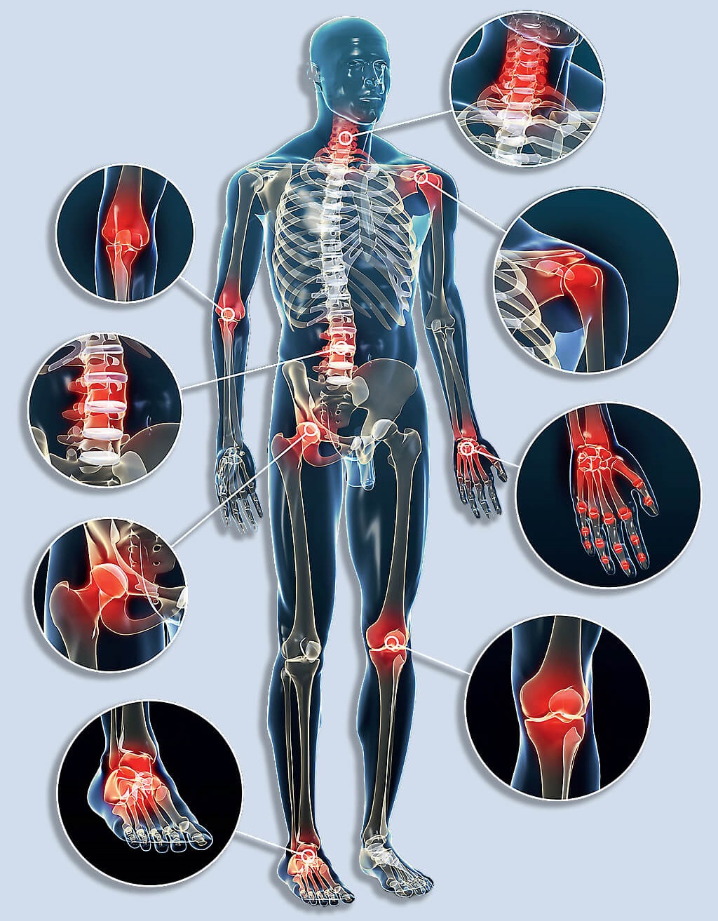 Ízületi fájdalmak okai és kezelése - Lágyrész károsodása a csontok ízületeiben