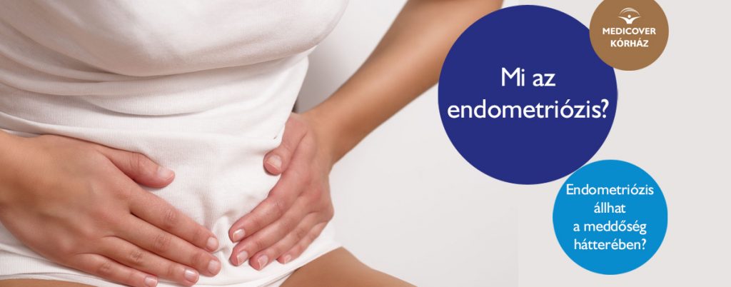 Endometriózis állhat a meddőség hátterében?