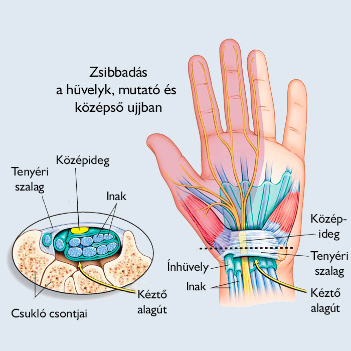 fáj a bal kéz középső ujjának ízülete