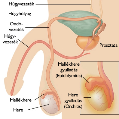 A prosztatagyulladás tünetei | BENU Gyógyszertárak