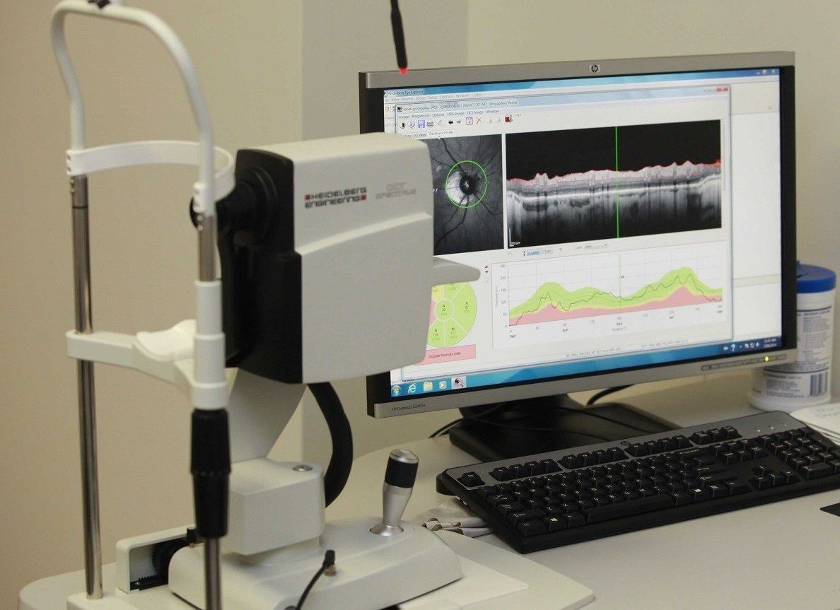 A retina optikai koherencia tomográfia (OCT vagy OCT) árai (makula és optikai lemez)
