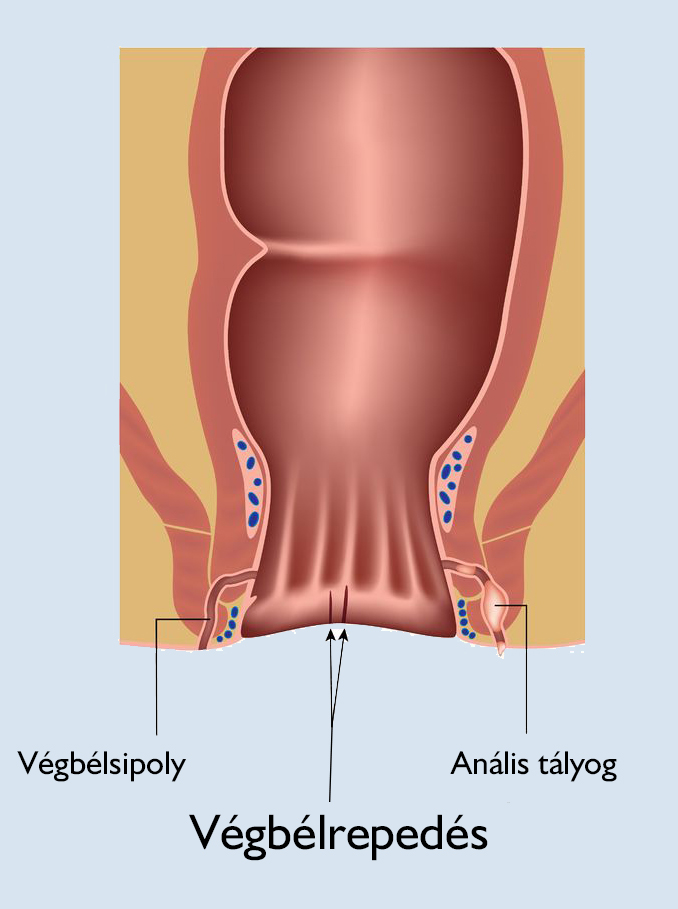 Prostatitis a fogantatáshoz Ciprolets a prostatitis alatt