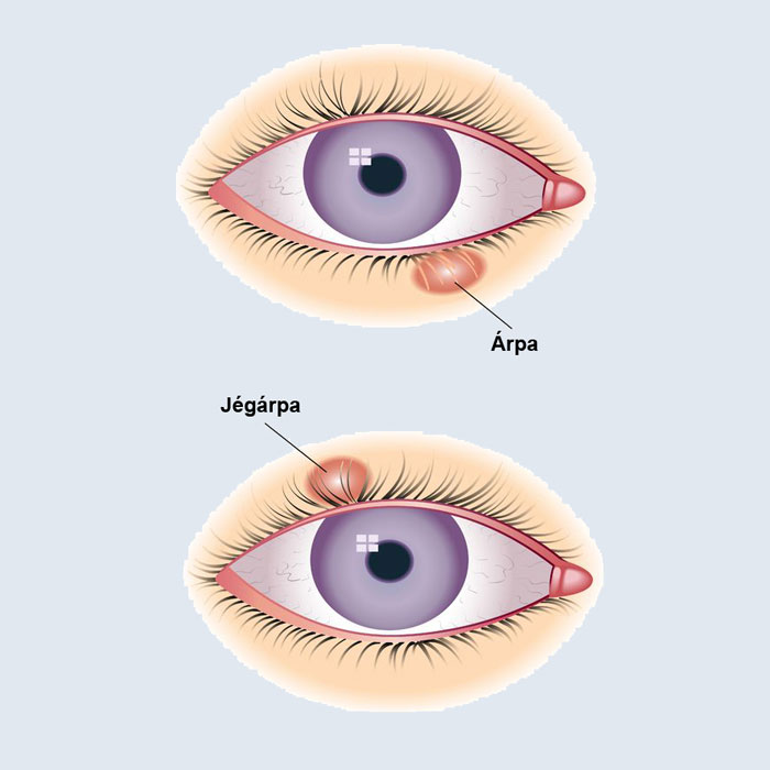 Akaratlan szemmozgás: a szemtekerezgés - Mi okozhatja?