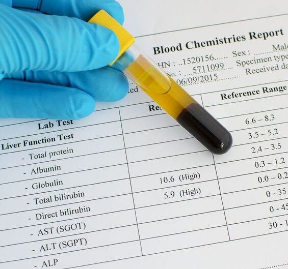 Laborvizsgálat - vérvizsgálat, vizeletvizsgálat szűrővizsgálatok