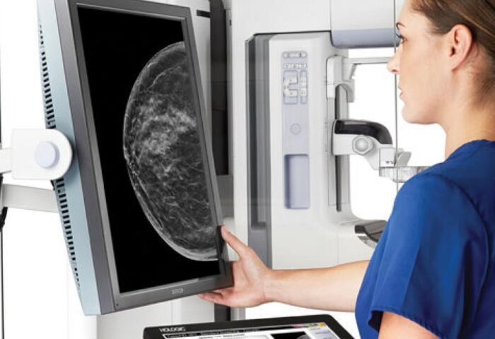 mammografia-vizsgalat